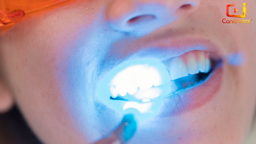 VÍDEO: ﻿Saúde em dia desta semana vai abordar mitos e verdades sobre clareamento dental