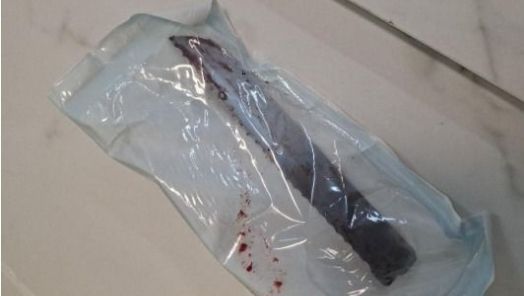 Homem que atingiu companheira com golpe de faca no olho é preso 