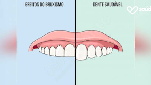 VÍDEO: Você sabe o que é bruxismo? Este é o assunto de hoje do quadro Saúde em Dia
