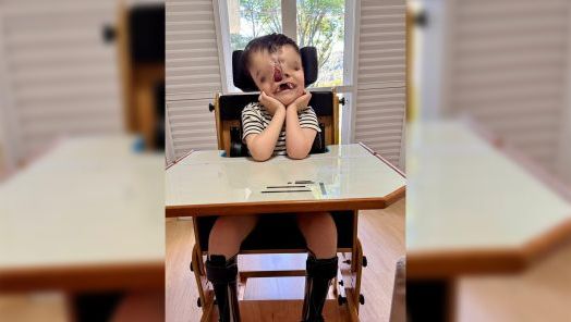 VÍDEO: família faz campanha para arrecadar valor de cirurgia de urgência para criança com malformação rara