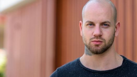 Cabelo Saudável: Pessoas carecas também podem ter caspa? 