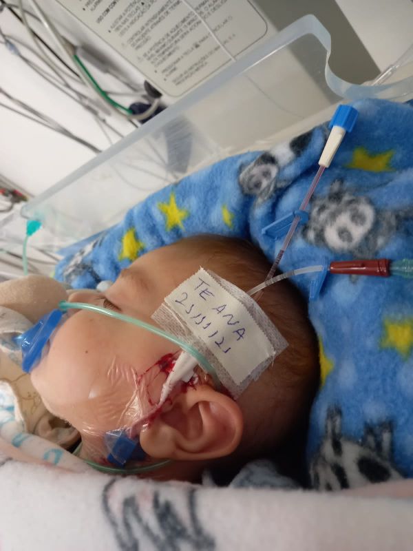 Theo recebe transfusão de sangue a cada 12 horas / Foto: Arquivo Pessoal