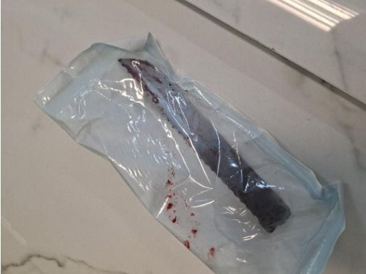 Homem que atingiu companheira com golpe de faca no olho é preso 