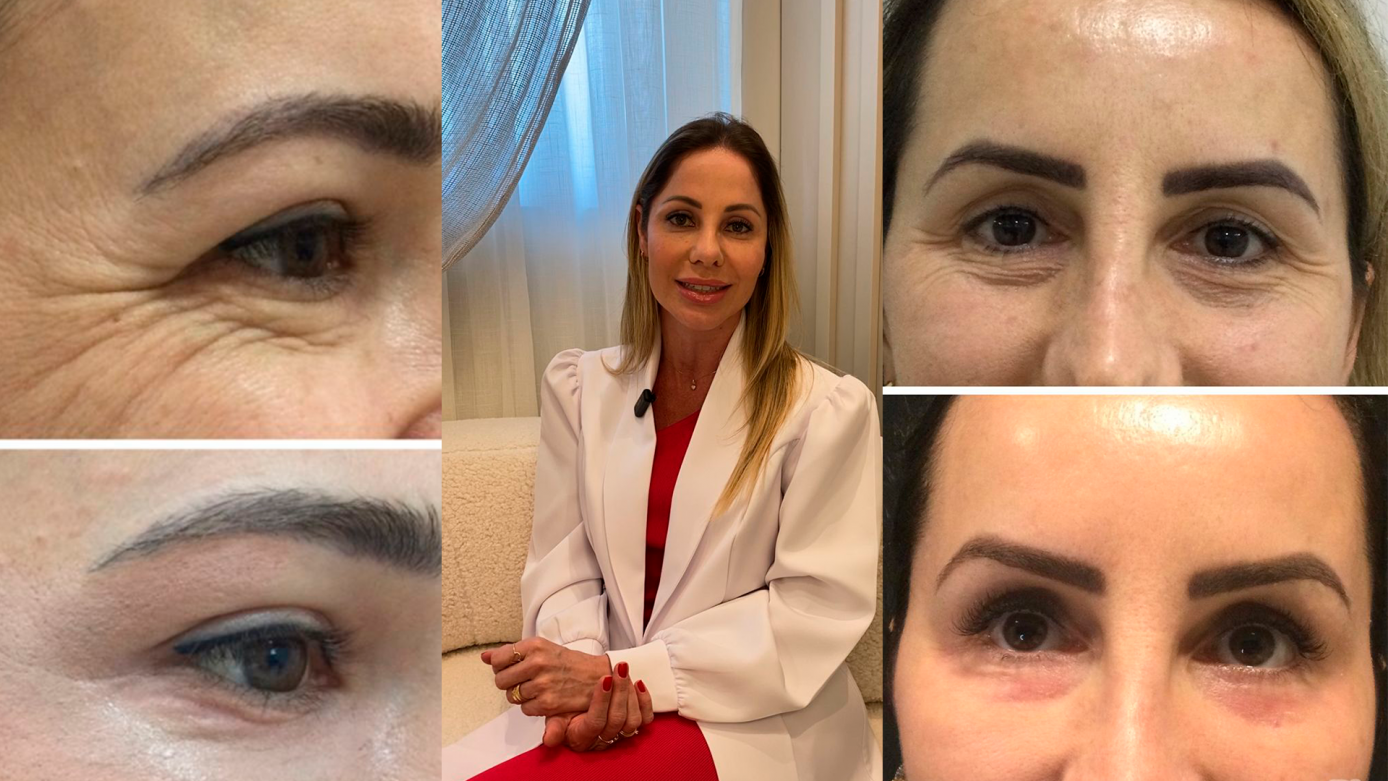 VÍDEO: Descubra o segredo para uma pele incrível, firme e rejuvenescida, com o Line Skin Hard! 